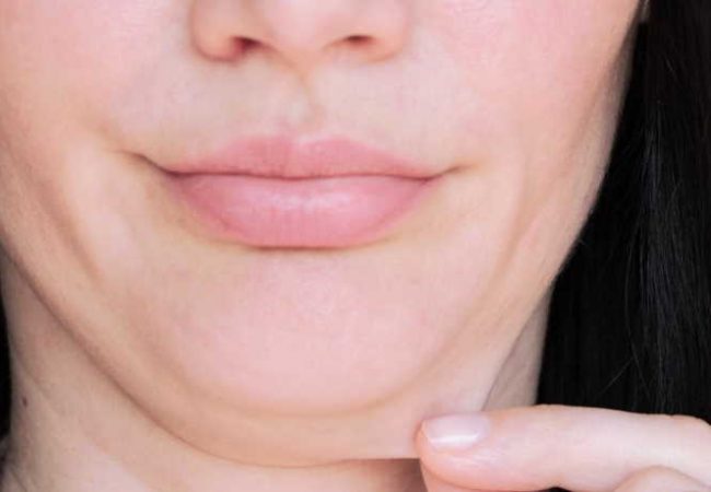 How To Reduce Double Chin?
